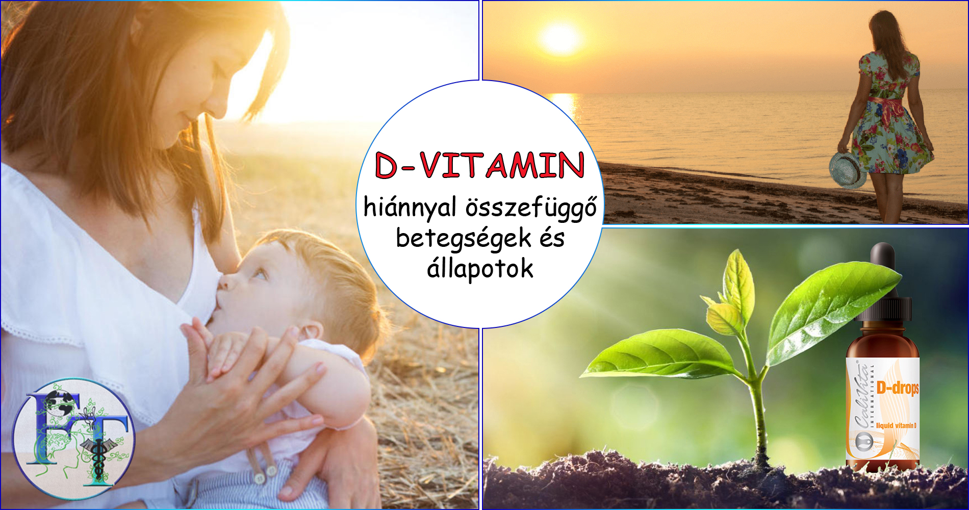 D vitamin hiánnyal összefüggő betegségek
